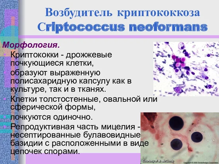 Возбудитель криптококкоза Сriptococcus neoformans Морфология. Криптококки - дрожжевые почкующиеся клетки,