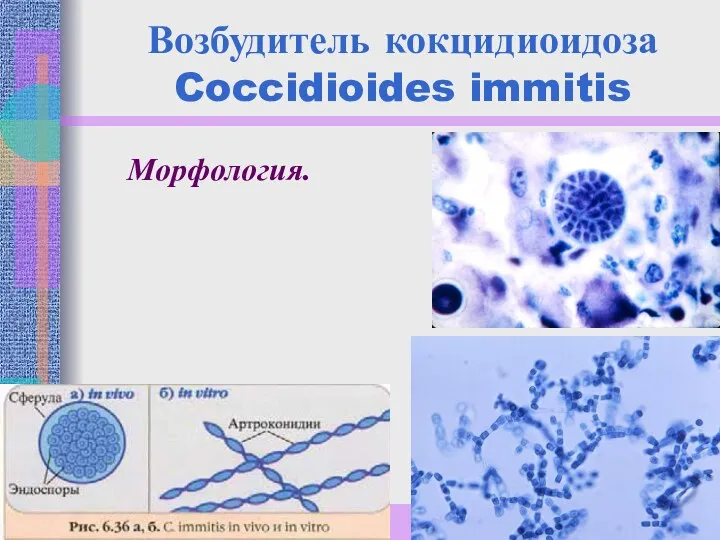Возбудитель кокцидиоидоза Coccidioides immitis Морфология.