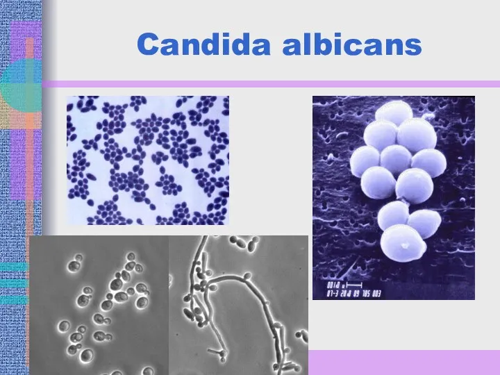 Candida albicans