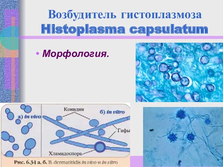 Возбудитель гистоплазмоза Histoplasma capsulatum Морфология.