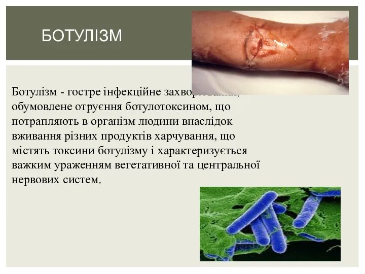 Ботулізм - гостре інфекційне захворювання, обумовлене отруєння ботулотоксином, що потрапляють в організм людини