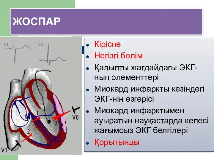ЖОСПАР Кіріспе Негізгі бөлім Қалыпты жағдайдағы ЭКГ-ның элементтері Миокард инфаркты кезіндегі ЭКГ-нің өзгерісі