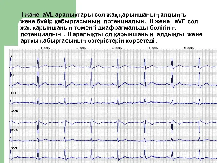 I және aVL аралықтары сол жақ қарыншаның алдыңғы және бүйір қабырғасының потенциалын .