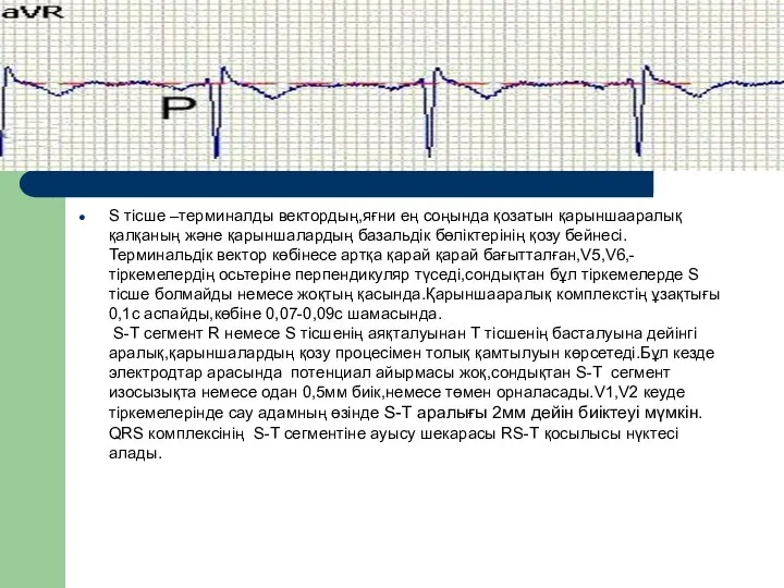 S тісше –терминалды вектордың,яғни ең соңында қозатын қарыншааралық қалқаның және қарыншалардың базальдік бөліктерінің