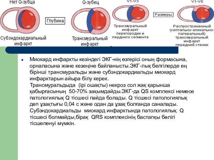 Миокард инфаркты кезіндегі ЭКГ-нің өзгерісі оның формасына,орналасына және кезеңіне байланысты.ЭКГ-лық белгілерде ең бірінші