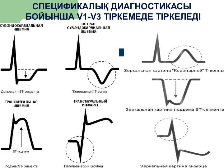 СПЕЦИФИКАЛЫҚ ДИАГНОСТИКАСЫ БОЙЫНША V1-V3 ТІРКЕМЕДЕ ТІРКЕЛЕДІ