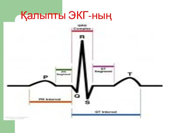 Қалыпты ЭКГ-ның элементтері