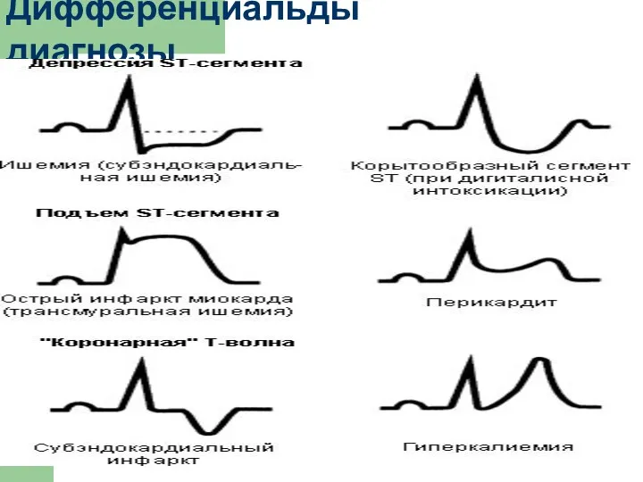 Дифференциальды диагнозы