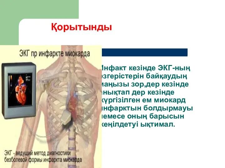 Инфакт кезінде ЭКГ-ның өзгерістерін байқаудың маңызы зор,дер кезінде анықтап дер кезінде жүргізілген ем