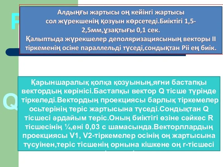 Р Q Қарыншаралық қолқа қозуының,яғни бастапқы вектордың көрінісі.Бастапқы вектор Q тісше түрінде тіркеледі.Вектордың