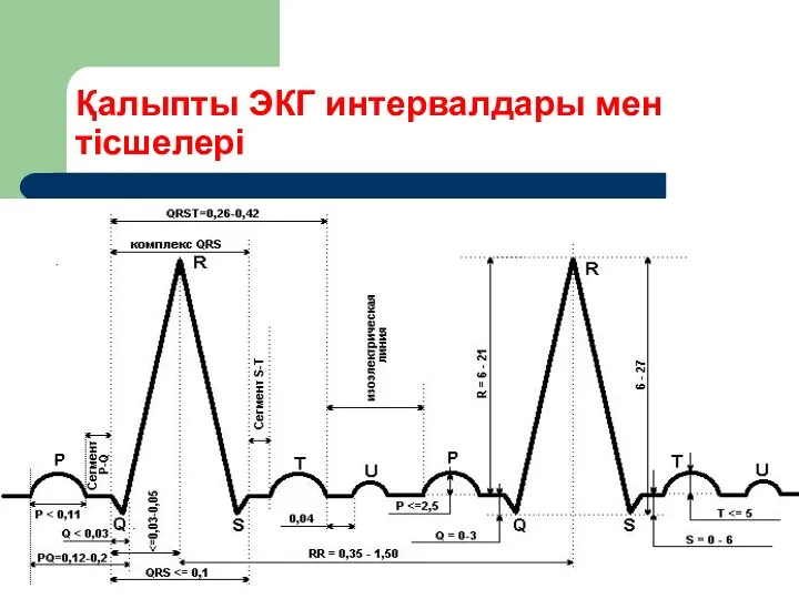 Қалыпты ЭКГ интервалдары мен тісшелері