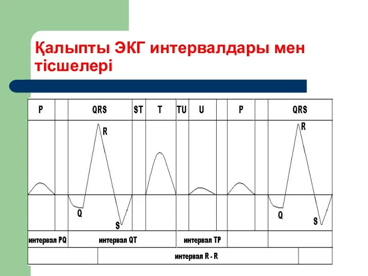 Қалыпты ЭКГ интервалдары мен тісшелері