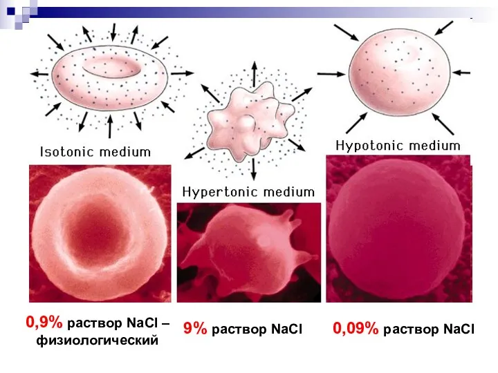 0,9% раствор NaCl – физиологический 0,9% раствор NaCl – физиологический 9% раствор NaCl 0,09% раствор NaCl