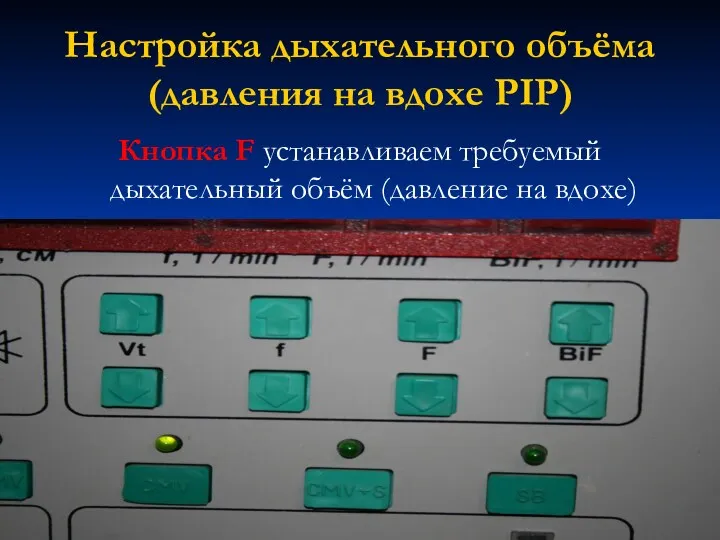 Настройка дыхательного объёма (давления на вдохе PIP) Кнопка F устанавливаем требуемый дыхательный объём (давление на вдохе)
