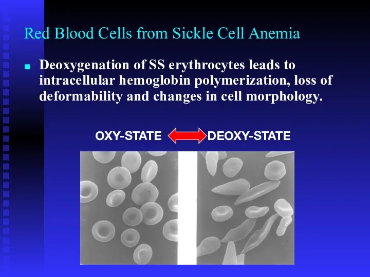 Red Blood Cells from Sickle Cell Anemia OXY-STATE DEOXY-STATE Deoxygenation