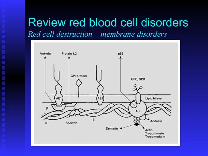 Review red blood cell disorders Red cell destruction – membrane disorders