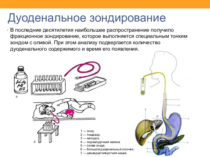 Дуоденальное зондирование В последние десятилетия наибольшее распространение получило фракционное зондирование,