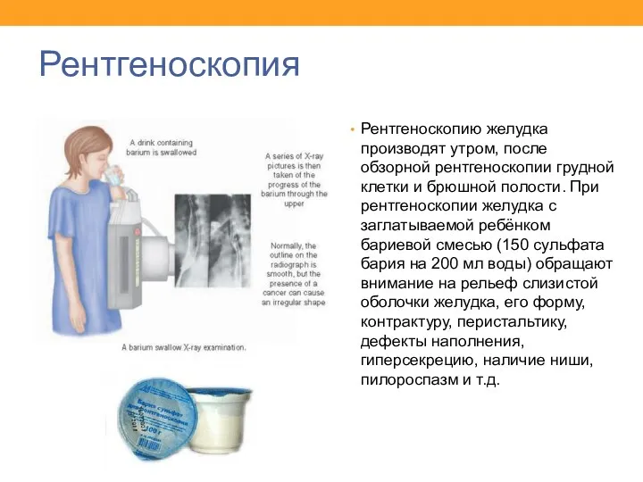 Рентгеноскопия Рентгеноскопию желудка производят утром, после обзорной рентгеноскопии грудной клетки