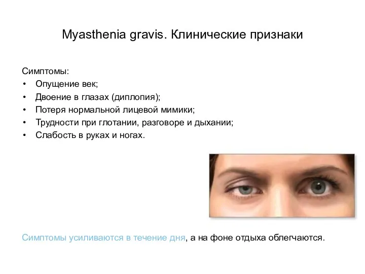 Myasthenia gravis. Клинические признаки Симптомы: Опущение век; Двоение в глазах