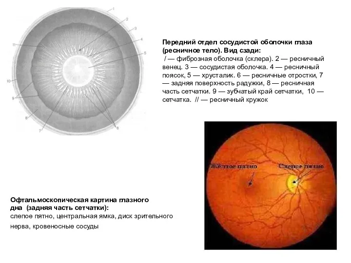 Передний отдел сосудистой оболочки глаза (ресничное тело). Вид сзади: / — фиброзная оболочка