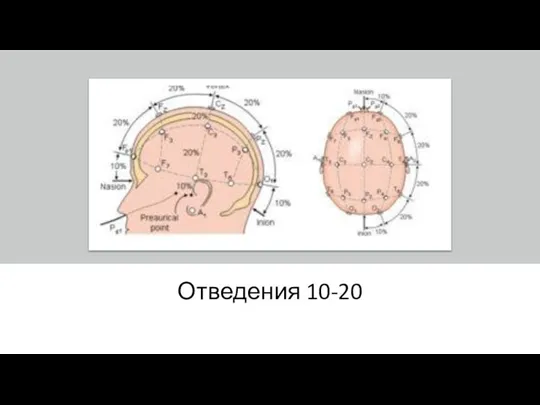 Отведения 10-20