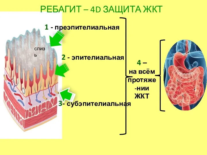 РЕБАГИТ – 4D ЗАЩИТА ЖКТ 1 - преэпителиальная 2 -