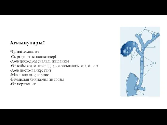 Асқынулары: -Іріңді холангит -Сыртқы өт жыланкөздері -Холедохо-дуоденальді жыланкөз -Өт қабы