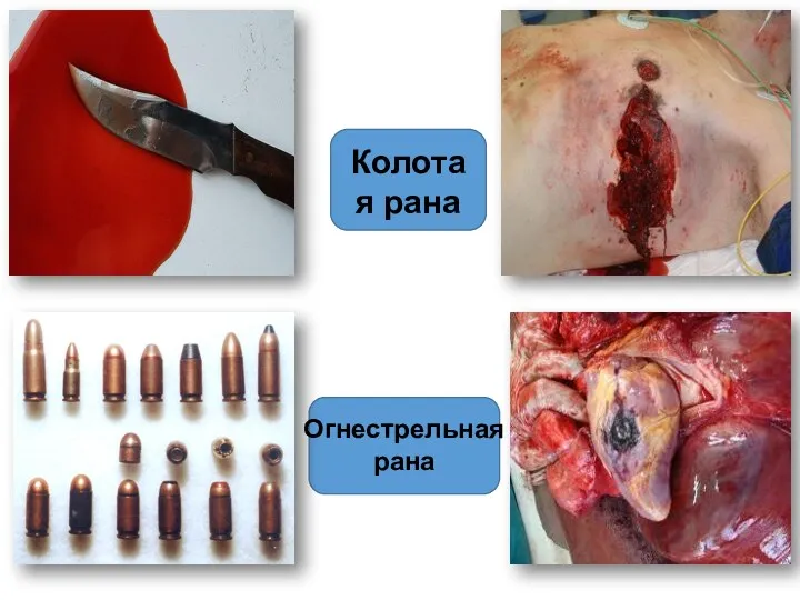 Колотая рана Огнестрельная рана