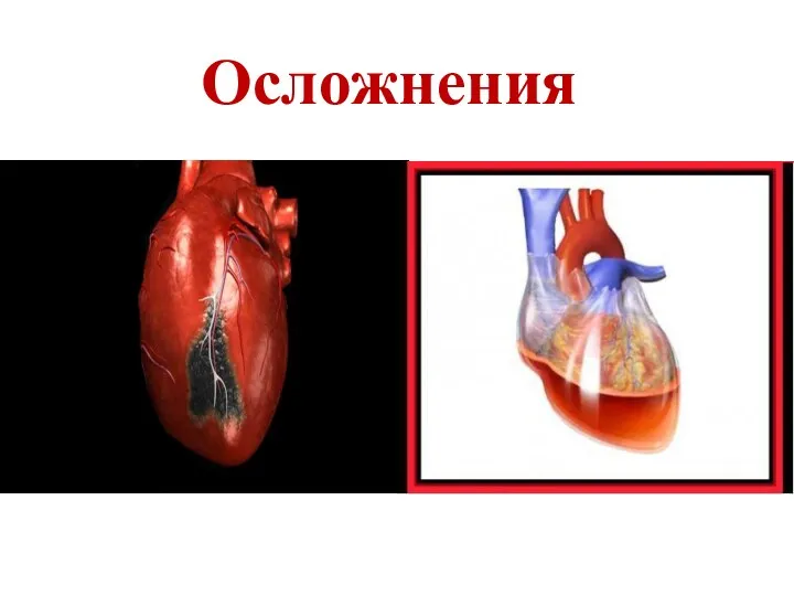 Осложнения