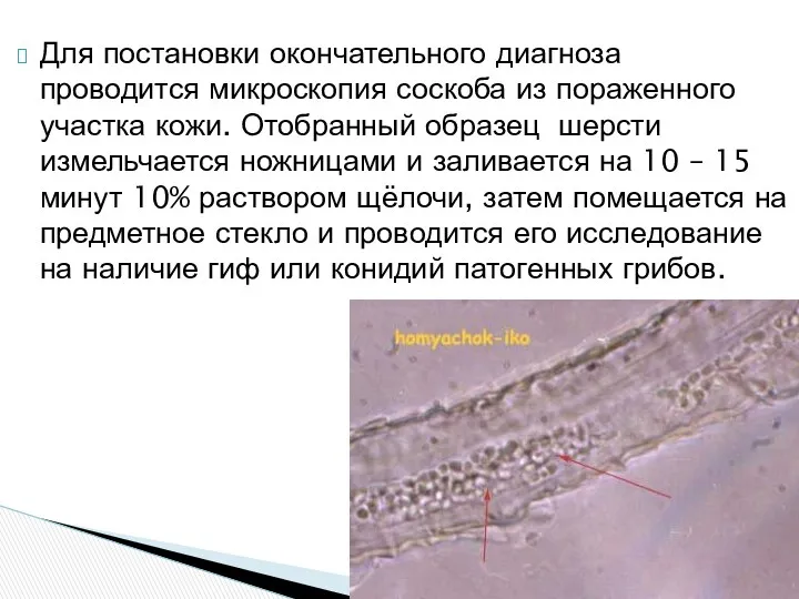 Для постановки окончательного диагноза проводится микроскопия соскоба из пораженного участка кожи. Отобранный образец