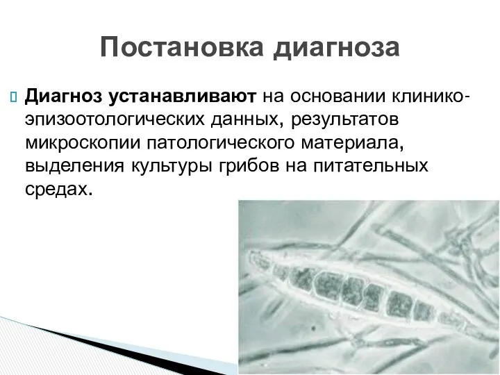 Диагноз устанавливают на основании клинико-эпизоотологических данных, результатов микроскопии патологического материала,