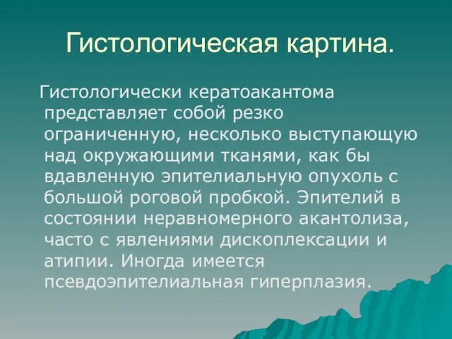 Гистологическая картина. Гистологически кератоакантома представляет собой резко ограниченную, несколько выступающую над окружающими тканями,