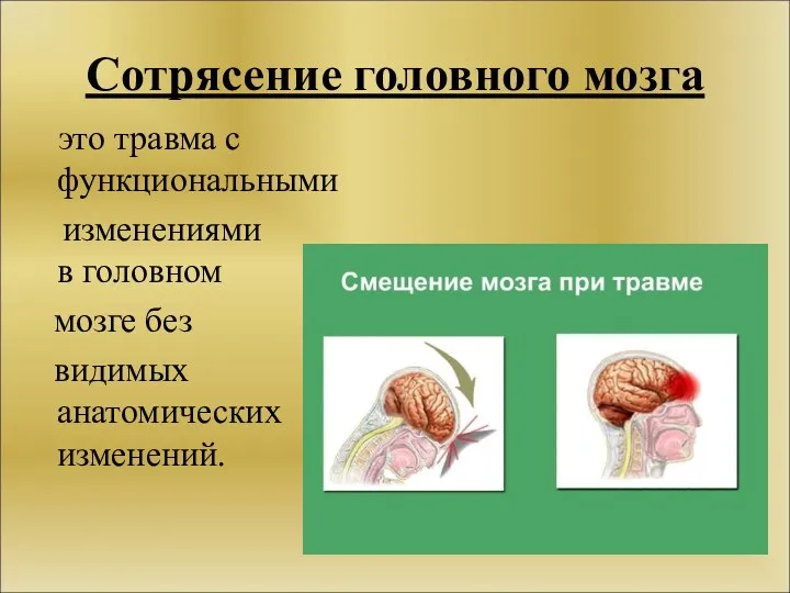 Сотрясение головного мозга это травма с функциональными изменениями в головном мозге без видимых анатомических изменений.