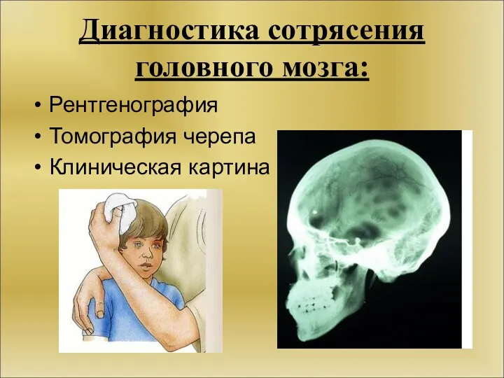 Диагностика сотрясения головного мозга: Рентгенография Томография черепа Клиническая картина