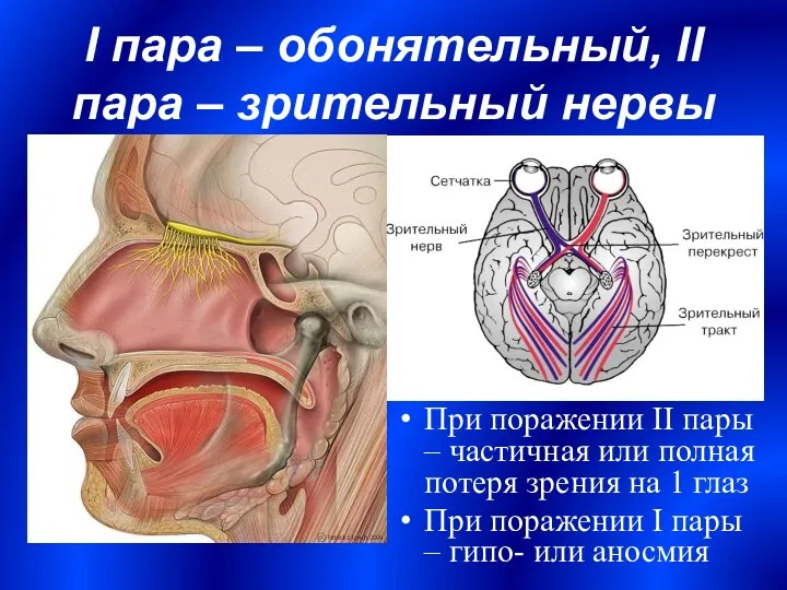 I пара – обонятельный, II пара – зрительный нервы При