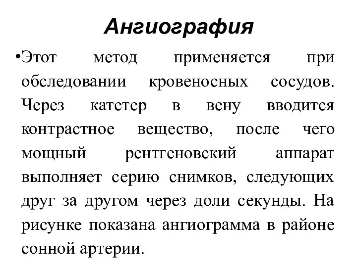 Этот метод применяется при обследовании кровеносных сосудов. Через катетер в