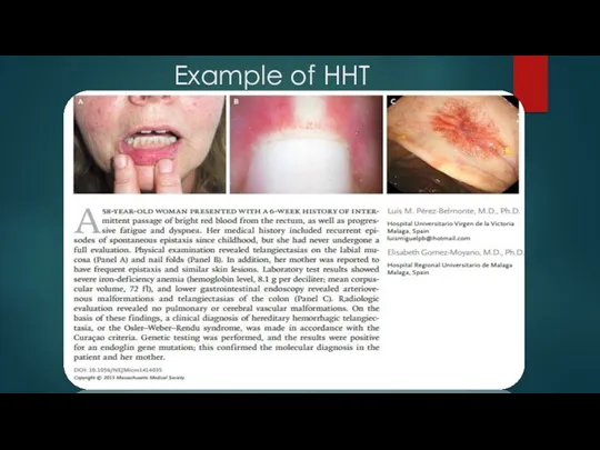 Example of HHT