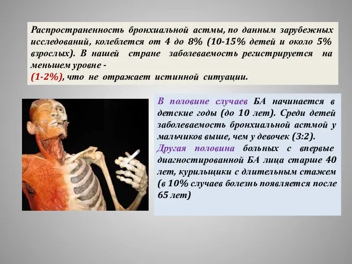 В половине случаев БА начинается в детские годы (до 10