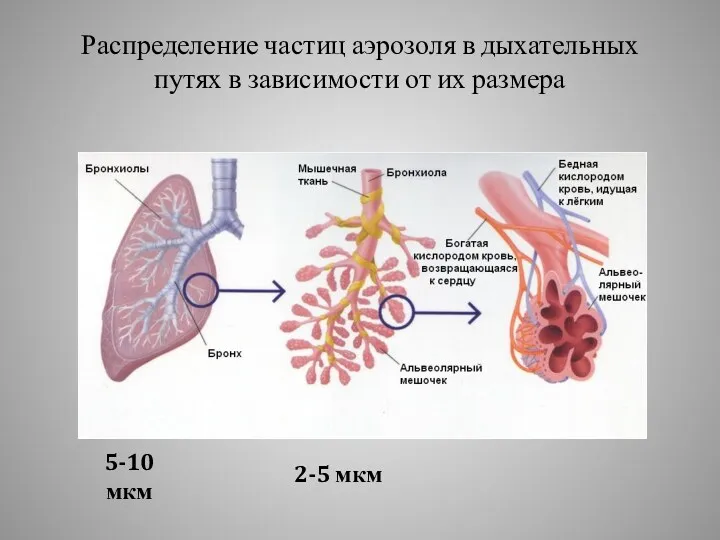 Распределение частиц аэрозоля в дыхательных путях в зависимости от их размера 5-10 мкм 2-5 мкм