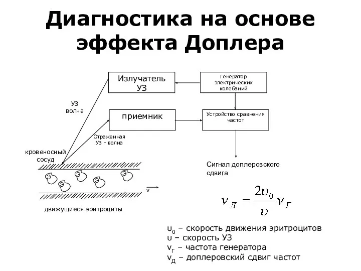 Диагностика на основе эффекта Доплера Излучатель УЗ Генератор электрических колебаний