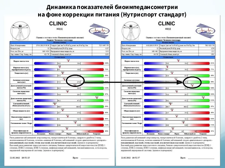 Динамика показателей биоимпедансометрии на фоне коррекции питания (Нутриспорт стандарт)