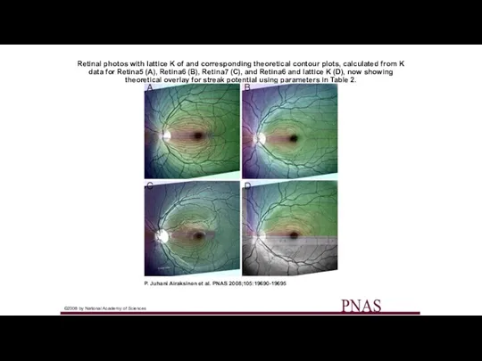 Retinal photos with lattice K of and corresponding theoretical contour