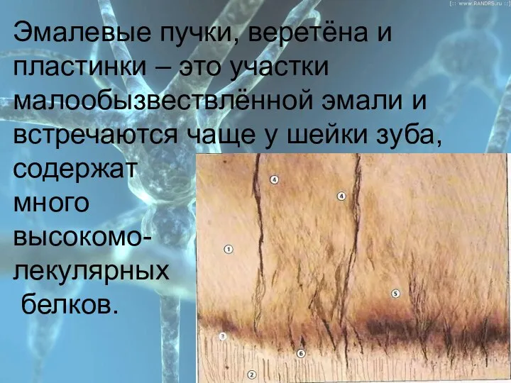 План Эмалевые пучки, веретёна и пластинки – это участки малообызвествлённой эмали и встречаются