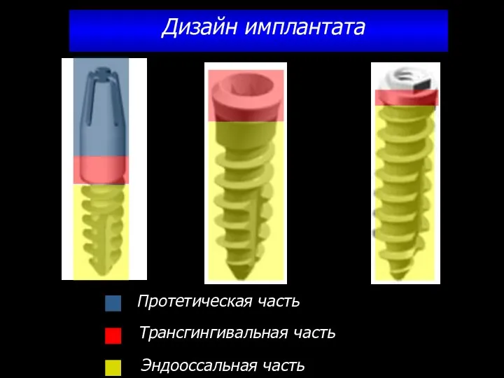 Дизайн имплантата
