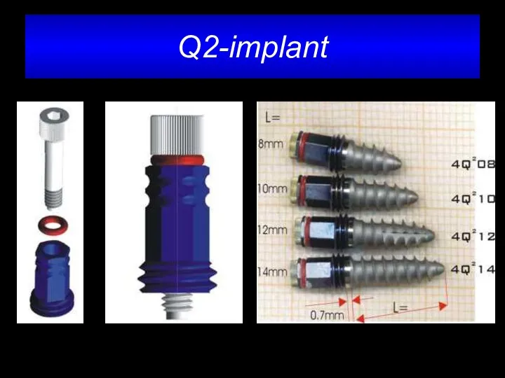 Q2-implant