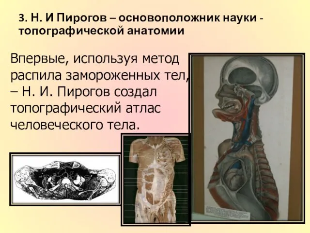 3. Н. И Пирогов – основоположник науки - топографической анатомии Впервые, используя метод