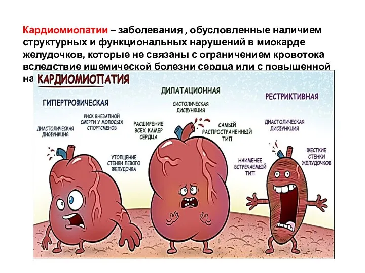 Кардиомиопатии – заболевания , обусловленные наличием структурных и функциональных нарушений