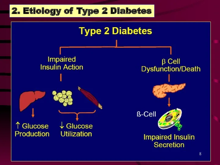 2. Etiology of Type 2 Diabetes