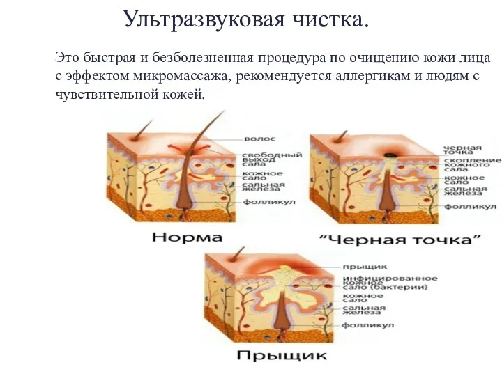 Это быстрая и безболезненная процедура по очищению кожи лица с