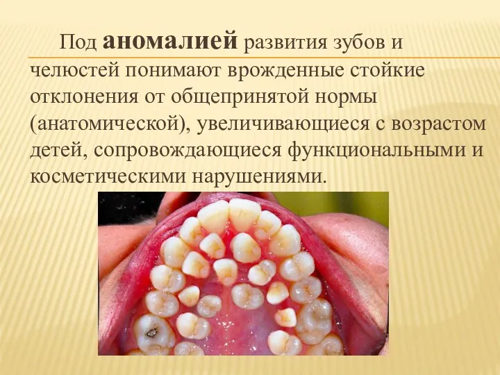 Под аномалией развития зубов и челюстей понимают врожденные стойкие отклонения